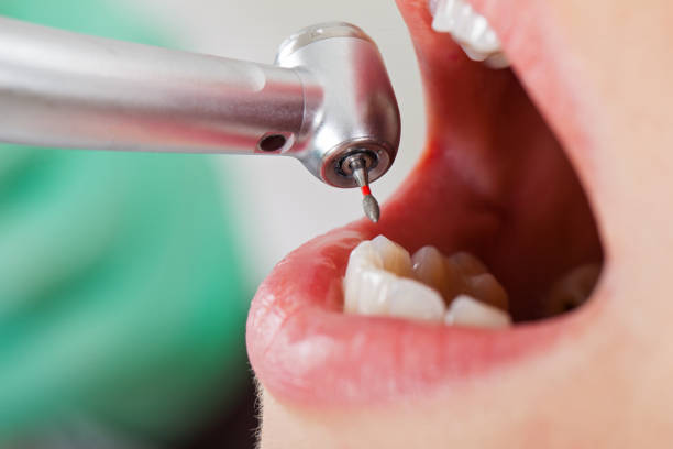 Best Emergency Dental Care for Broken or Chipped Teeth in Earlimart, CA